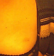 on that part of the breast, where it's quite tender on that part of the breast, where it's quite tender